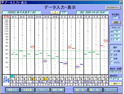 「ノイロヴィジョン」の画像検索結果